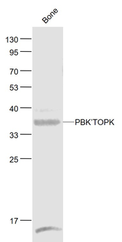 PBK/TOPK Rabbit Polyclonal Antibody