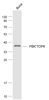 PBK/TOPK Rabbit Polyclonal Antibody