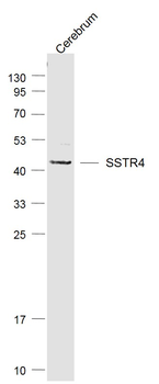 SSTR4 Rabbit Polyclonal Antibody