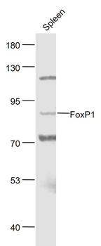 FoxP1 Rabbit Polyclonal Antibody