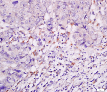 FAIM3 Rabbit Polyclonal Antibody