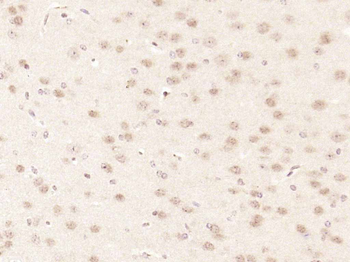 CDKN2A/p16-INK4a Rabbit Polyclonal Antibody