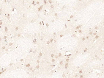 CDKN2A/p16-INK4a Rabbit Polyclonal Antibody