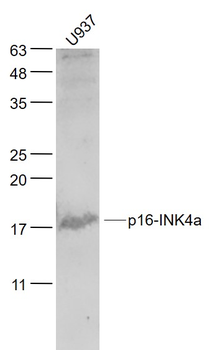 CDKN2A/p16-INK4a Rabbit Polyclonal Antibody