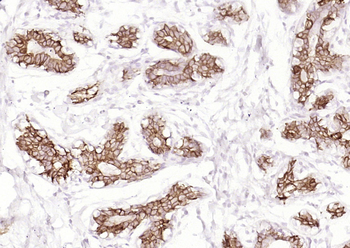 Cytokeratin 19 (ready to use) Mouse Monoclonal Antibody