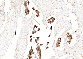 Cytokeratin 19 (ready to use) Mouse Monoclonal Antibody