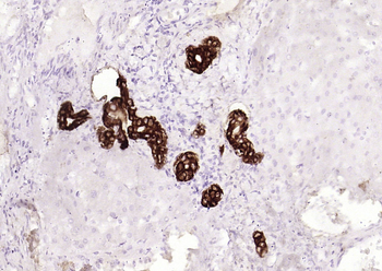 Cytokeratin 19 (ready to use) Mouse Monoclonal Antibody