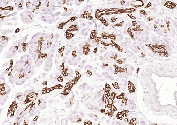 Cytokeratin 19 (ready to use) Mouse Monoclonal Antibody