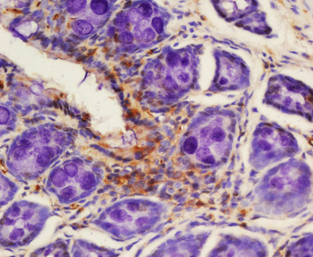 TSLC1 Rabbit Polyclonal Antibody