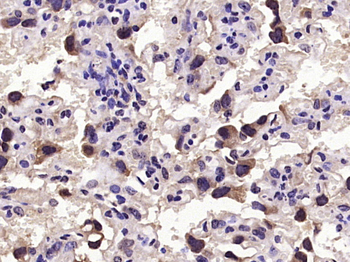 GDF15 Rabbit Polyclonal Antibody