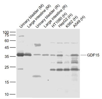 GDF15 Rabbit Polyclonal Antibody