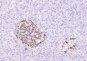 Glucagon Rabbit Polyclonal Antibody