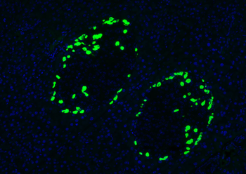 Glucagon Rabbit Polyclonal Antibody