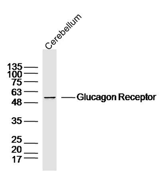 Glucagon Receptor Rabbit Polyclonal Antibody