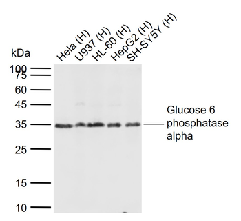 G6PC Rabbit Polyclonal Antibody