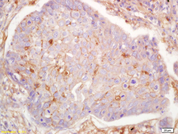 GNAS Rabbit Polyclonal Antibody