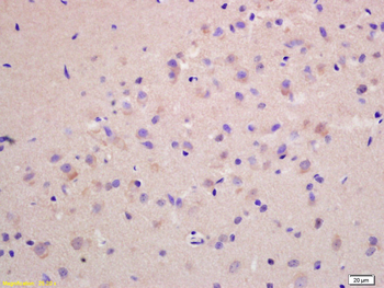 GNAS Rabbit Polyclonal Antibody