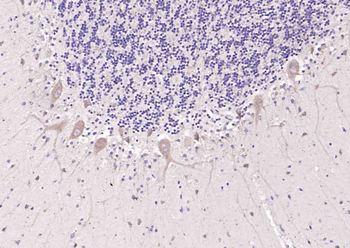 GNB3 Rabbit Polyclonal Antibody