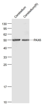 PAX6 Rabbit Polyclonal Antibody