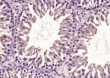 IL17RB Rabbit Polyclonal Antibody