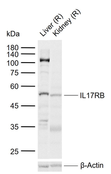 IL17RB Rabbit Polyclonal Antibody