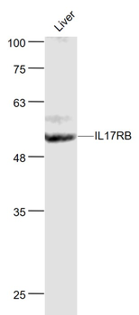 IL17RB Rabbit Polyclonal Antibody