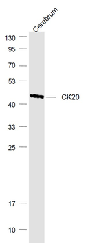 CK20 Rabbit Polyclonal Antibody