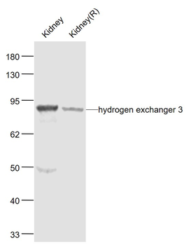 Hydrogen exchanger 3 Rabbit Polyclonal Antibody