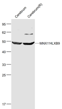 MNX1/HLXB9 Rabbit Polyclonal Antibody