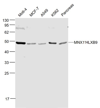 MNX1/HLXB9 Rabbit Polyclonal Antibody