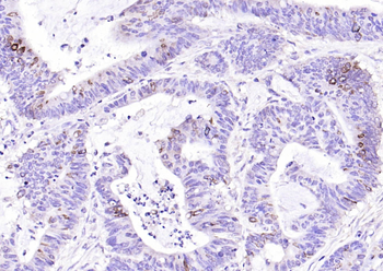 IL13RA2 Rabbit Polyclonal Antibody