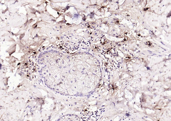 Mast Cell Tryptase Recombinant Rabbit Monoclonal Antibody