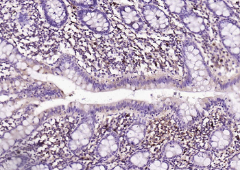 Mast Cell Tryptase Recombinant Rabbit Monoclonal Antibody
