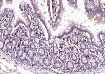 Mast Cell Tryptase Recombinant Rabbit Monoclonal Antibody