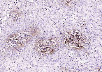 Mast Cell Tryptase Recombinant Rabbit Monoclonal Antibody