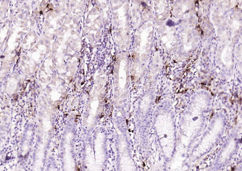 Mast Cell Tryptase Recombinant Rabbit Monoclonal Antibody