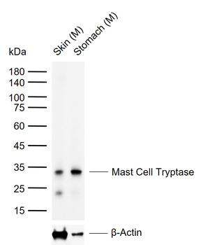 Mast Cell Tryptase Recombinant Rabbit Monoclonal Antibody