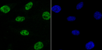 NRF1 Recombinant Rabbit Monoclonal Antibody