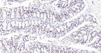PCNA Recombinant Rabbit Monoclonal Antibody (Nuclear Loading Control)
