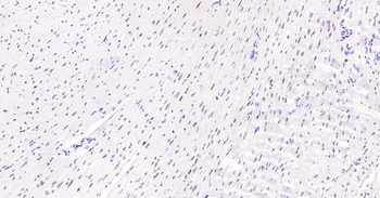 PCNA Recombinant Rabbit Monoclonal Antibody (Nuclear Loading Control)