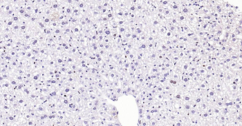 PCNA Recombinant Rabbit Monoclonal Antibody (Nuclear Loading Control)