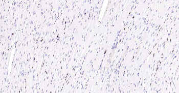 PCNA Recombinant Rabbit Monoclonal Antibody (Nuclear Loading Control)