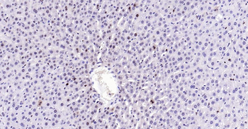 PCNA Recombinant Rabbit Monoclonal Antibody (Nuclear Loading Control)