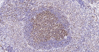 PCNA Recombinant Rabbit Monoclonal Antibody (Nuclear Loading Control)