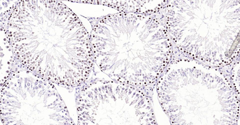 PCNA Recombinant Rabbit Monoclonal Antibody (Nuclear Loading Control)