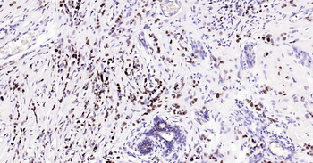 PCNA Recombinant Rabbit Monoclonal Antibody (Nuclear Loading Control)