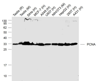 PCNA Recombinant Rabbit Monoclonal Antibody (Nuclear Loading Control)