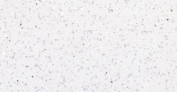 PCNA Recombinant Rabbit Monoclonal Antibody (Nuclear Loading Control)