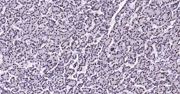 PCNA Recombinant Rabbit Monoclonal Antibody (Nuclear Loading Control)