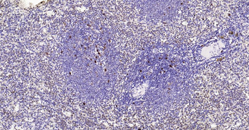 PCNA Recombinant Rabbit Monoclonal Antibody (Nuclear Loading Control)